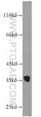 Solute Carrier Family 25 Member 18 antibody, 17348-1-AP, Proteintech Group, Western Blot image 