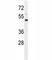 Interleukin 1 Receptor Type 2 antibody, F41147-0.4ML, NSJ Bioreagents, Western Blot image 