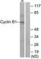 Cyclin B1 antibody, TA312648, Origene, Western Blot image 