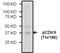 Cyclin Dependent Kinase 9 antibody, PA5-17197, Invitrogen Antibodies, Western Blot image 
