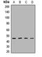 Phosphatidylinositol-5-Phosphate 4-Kinase Type 2 Alpha antibody, LS-C667962, Lifespan Biosciences, Western Blot image 