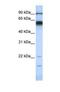 Matrix Metallopeptidase 16 antibody, NBP1-69349, Novus Biologicals, Western Blot image 