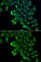 Fatty Acid Binding Protein 5 antibody, GTX33191, GeneTex, Immunocytochemistry image 