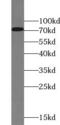 Leucine Rich Repeat Containing 4C antibody, FNab04859, FineTest, Western Blot image 