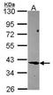 Filamin Binding LIM Protein 1 antibody, GTX116584, GeneTex, Western Blot image 