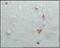 Crystallin Alpha B antibody, 32-140, ProSci, Immunohistochemistry paraffin image 