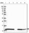 10 kDa heat shock protein, mitochondrial antibody, NBP2-34055, Novus Biologicals, Western Blot image 