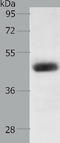 Lysophosphatidic Acid Receptor 4 antibody, TA321702, Origene, Western Blot image 