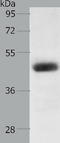 LPA4 antibody, TA321702, Origene, Western Blot image 