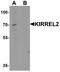 Kirre Like Nephrin Family Adhesion Molecule 2 antibody, A07812, Boster Biological Technology, Western Blot image 