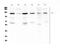 Platelet Derived Growth Factor Receptor Beta antibody, A00096-1, Boster Biological Technology, Western Blot image 