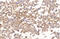 Glypican 3 antibody, GTX633410, GeneTex, Immunohistochemistry paraffin image 