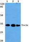 Transformer 2 Alpha Homolog antibody, PA5-75290, Invitrogen Antibodies, Western Blot image 