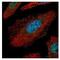 TGF-Beta Activated Kinase 1 (MAP3K7) Binding Protein 1 antibody, NBP2-20552, Novus Biologicals, Immunocytochemistry image 