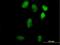 Lin-9 DREAM MuvB Core Complex Component antibody, H00286826-B01P, Novus Biologicals, Immunocytochemistry image 
