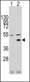 WNT Inhibitory Factor 1 antibody, LS-B9035, Lifespan Biosciences, Western Blot image 