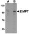 Zinc Finger MIZ-Type Containing 2 antibody, orb75587, Biorbyt, Western Blot image 
