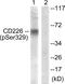CD226 Molecule antibody, PA5-38444, Invitrogen Antibodies, Western Blot image 