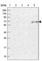 ETF dehydrogenase antibody, PA5-59808, Invitrogen Antibodies, Western Blot image 
