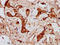 Codanin 1 antibody, LS-C680256, Lifespan Biosciences, Immunohistochemistry paraffin image 