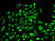 Sphingosine Kinase 1 antibody, A0139, ABclonal Technology, Immunofluorescence image 