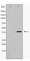 Myocyte-specific enhancer factor 2C antibody, TA348003, Origene, Western Blot image 