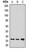 Rtp801 antibody, LS-C668431, Lifespan Biosciences, Western Blot image 