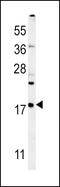 Vesicle-associated membrane protein 4 antibody, 62-077, ProSci, Western Blot image 