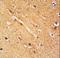 Ankyrin Repeat And FYVE Domain Containing 1 antibody, LS-C156338, Lifespan Biosciences, Immunohistochemistry paraffin image 