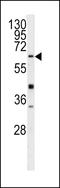 Gamma-Glutamyltransferase 5 antibody, LS-C100585, Lifespan Biosciences, Western Blot image 