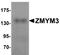 Zinc Finger MYM-Type Containing 3 antibody, A08961, Boster Biological Technology, Western Blot image 