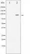 Insulin Receptor antibody, abx010358, Abbexa, Western Blot image 