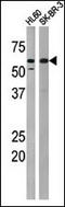 Protein Kinase, Membrane Associated Tyrosine/Threonine 1 antibody, LS-C96913, Lifespan Biosciences, Western Blot image 