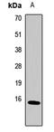 Metallothionein 2A antibody, LS-C667906, Lifespan Biosciences, Western Blot image 