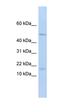 V-Set Pre-B Cell Surrogate Light Chain 1 antibody, orb324997, Biorbyt, Western Blot image 