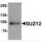 SUZ12 Polycomb Repressive Complex 2 Subunit antibody, MBS153413, MyBioSource, Western Blot image 