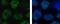 BRCA1 DNA Repair Associated antibody, NB100-404, Novus Biologicals, Immunocytochemistry image 