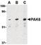 P21 (RAC1) Activated Kinase 6 antibody, PA5-20231, Invitrogen Antibodies, Western Blot image 