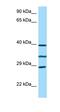 RP9 Pre-MRNA Splicing Factor antibody, orb326482, Biorbyt, Western Blot image 