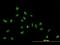 Zinc Finger Protein 593 antibody, H00051042-B01P, Novus Biologicals, Immunofluorescence image 