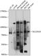 Solute Carrier Family 22 Member 23 antibody, 15-529, ProSci, Western Blot image 