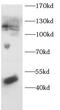 PPARG Coactivator 1 Alpha antibody, FNab10788, FineTest, Western Blot image 