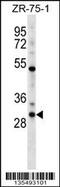 Homeobox D1 antibody, 58-366, ProSci, Western Blot image 