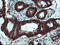 Tubulin Folding Cofactor C antibody, M06952-1, Boster Biological Technology, Immunohistochemistry paraffin image 