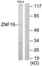 Zinc Finger Protein 18 antibody, PA5-38580, Invitrogen Antibodies, Western Blot image 