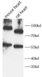 CD34 antibody, FNab10408, FineTest, Western Blot image 