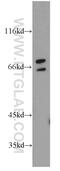 ST6 N-Acetylgalactosaminide Alpha-2,6-Sialyltransferase 1 antibody, 15363-1-AP, Proteintech Group, Western Blot image 