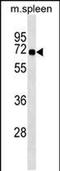 Syntrophin Beta 1 antibody, PA5-48888, Invitrogen Antibodies, Western Blot image 