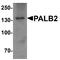 Partner And Localizer Of BRCA2 antibody, A00639, Boster Biological Technology, Western Blot image 
