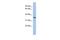 Peroxisomal Biogenesis Factor 7 antibody, GTX45111, GeneTex, Western Blot image 